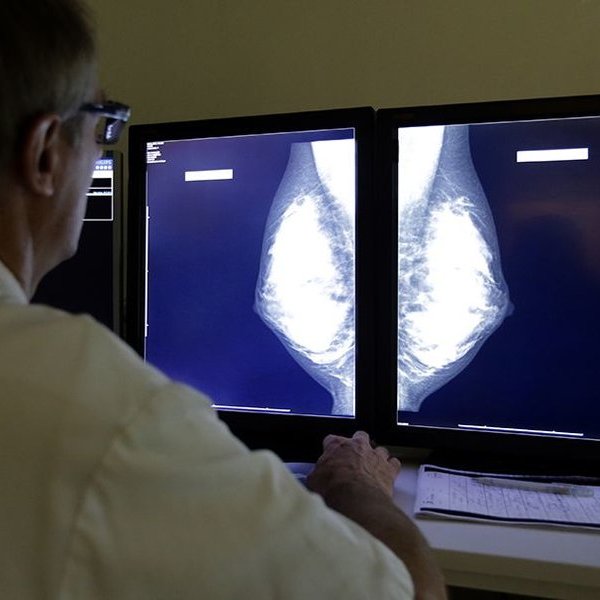 медицина, болезнь, организм человека, Найден способ лечения самого опасного рака груди